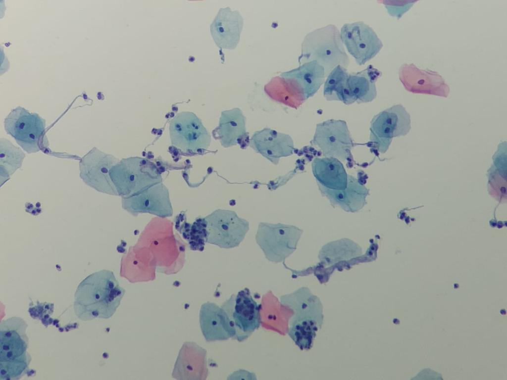 GynoPrep® Processor GP-100 - Processador Automatizado para Citologia em meio Líquido