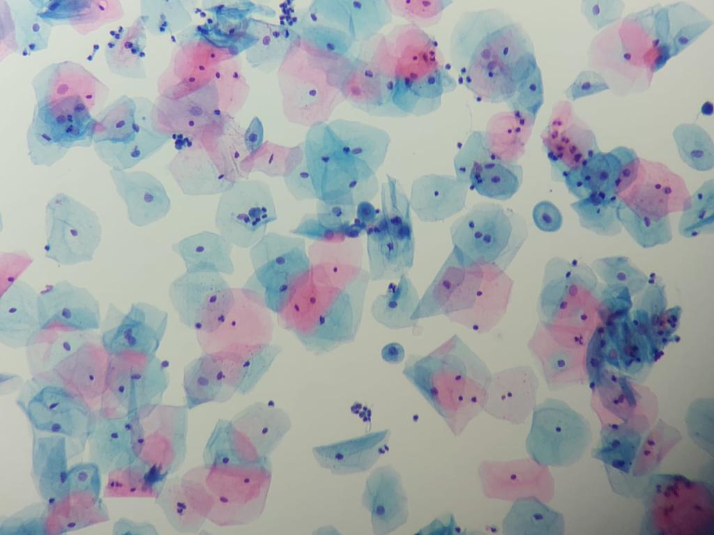 GynoPrep® Processor GP-100 - Processador Automatizado para Citologia em meio Líquido