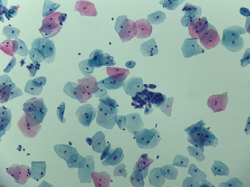 GynoPrep® Processor GP-100 - Processador Automatizado para Citologia em meio Líquido