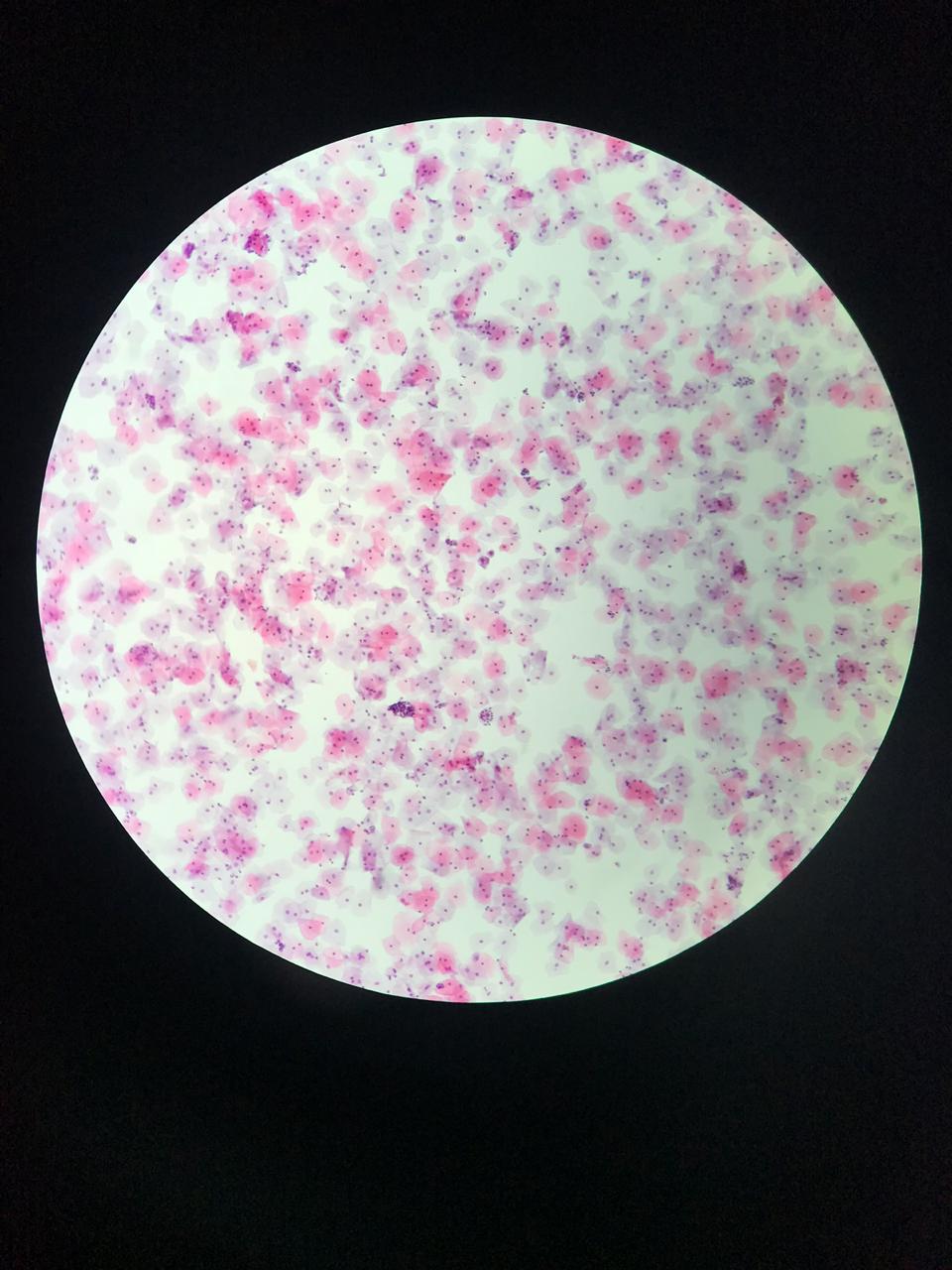 GynoPrep® Processor GP-100 - Processador Automatizado para Citologia em meio Líquido