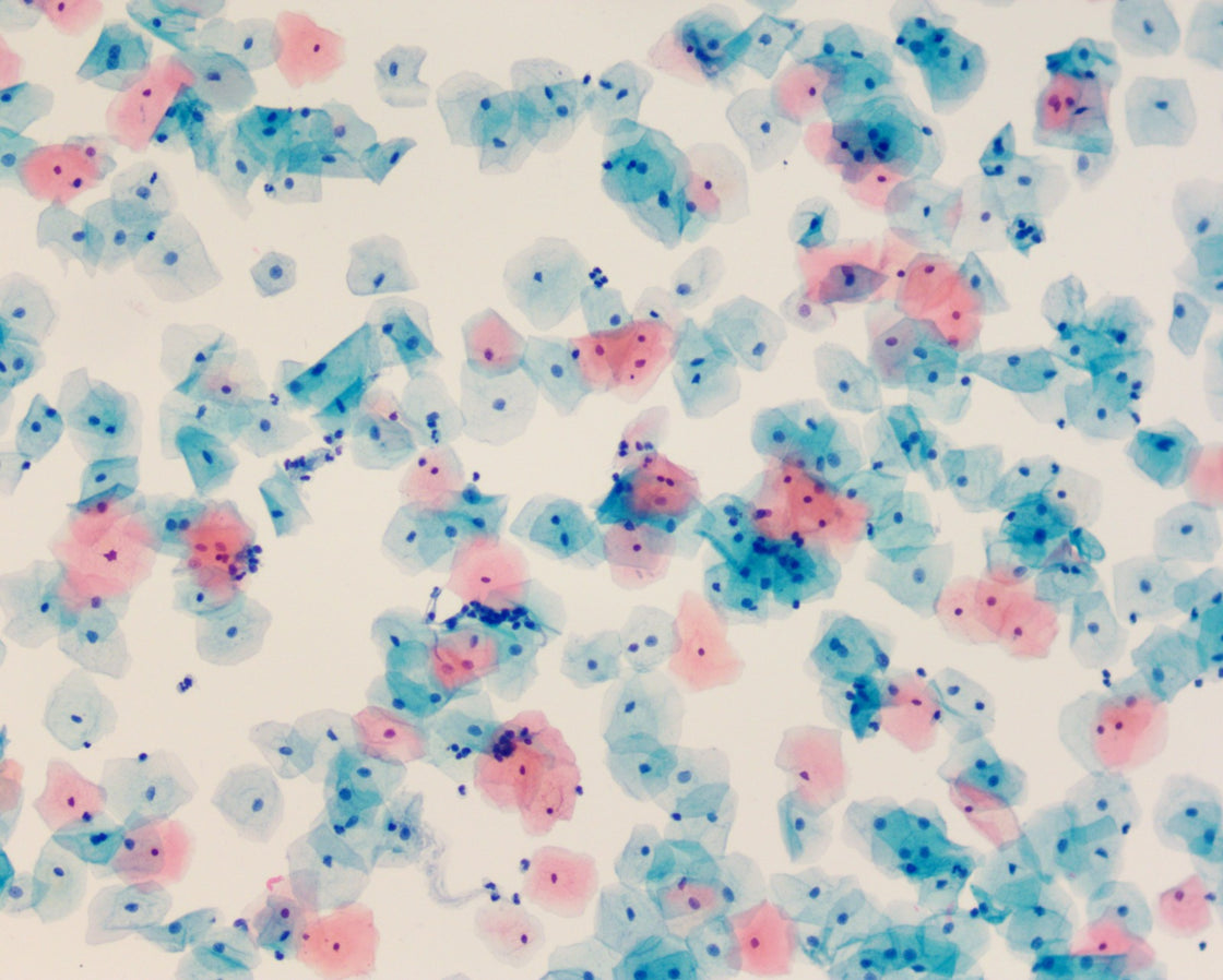 GynoPrep® Processor GP-100 - Processador Automatizado para Citologia em meio Líquido