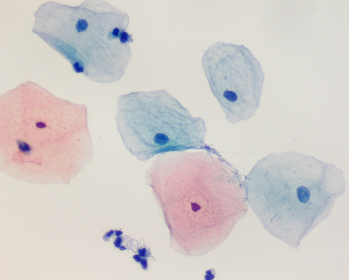 GynoPrep® Processor GP-100 - Processador Automatizado para Citologia em meio Líquido