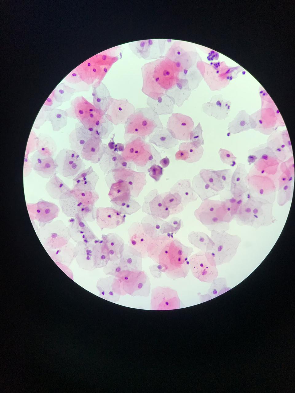 GynoPrep® Processor GP-100 - Processador Automatizado para Citologia em meio Líquido